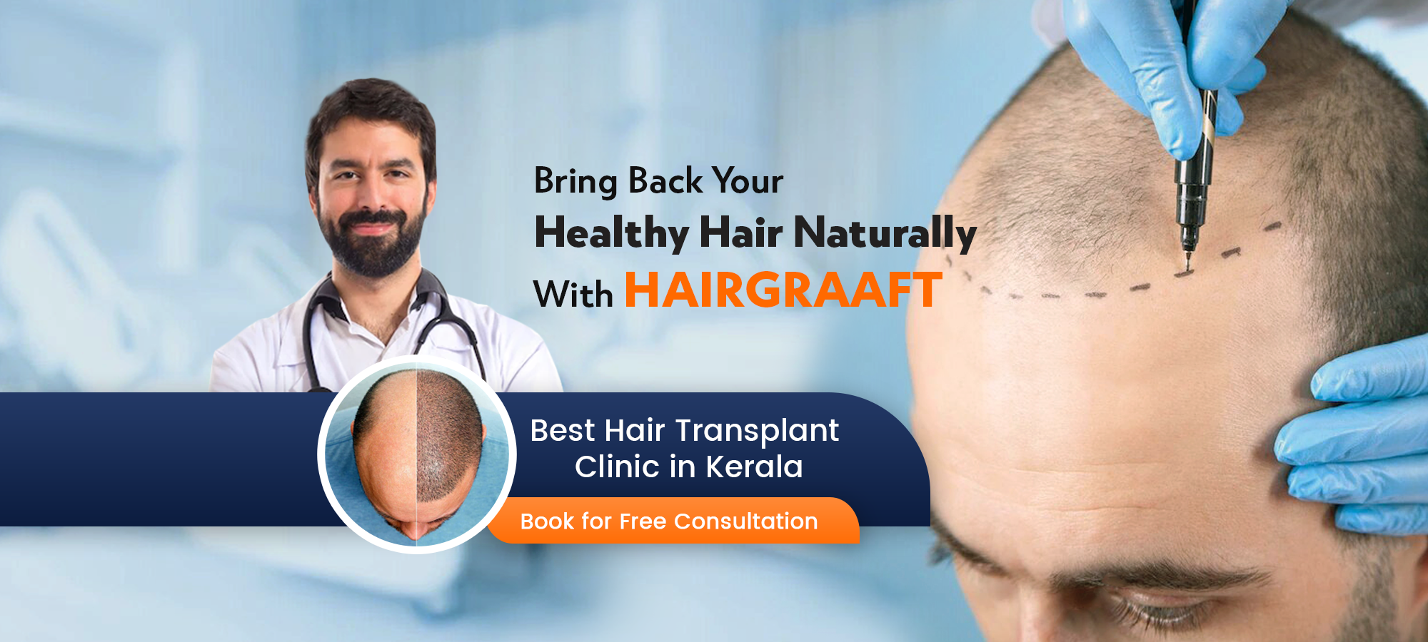 Hair Transplant Clinic in Kerala | Hair Loss Treatment in Kottayam& Calicut